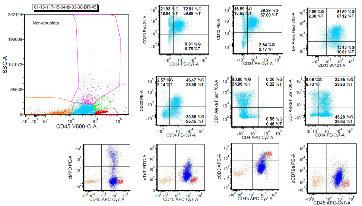 WVUHemePath's tweet photo. #FlowFriday Another #FlowMo correlation...
55M with pancytopenia, including absolute neutropenia & lymphopenia. Bone marrow aspirate for #FlowCytometry.
Additional markers? Thoughts?
Morphologic correlation with morphology in upcoming #MarrowMonday!
Case Credit: @docmauten https://t.co/5YG2IILyVY