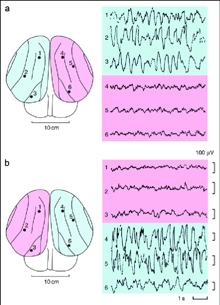 No obstante, obtienen el descanso que necesitan durmiendo unihemisferialmente. Es decir, descansando la mitad de un hemisferio y luego el otro. https://www.researchgate.net/publication/43328803_The_Evolution_of_Sleep