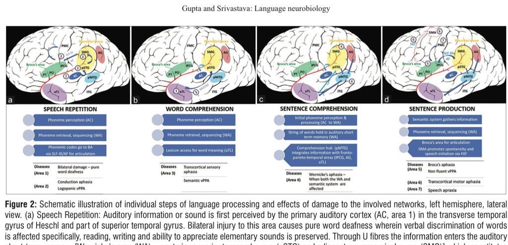 Anu Gupta (@anu_gupta_aiims) on Twitter photo Happy to share our AIAN review on ‘Newer paradigms in language neurobiology’ @AcademyofNeuro1 <a href="/AiimsNeurology/">AIIMS_Neurology</a> <a href="/aiims_newdelhi/">AIIMS, New Delhi 🇮🇳</a> #dementia #aphasia #languagemodels annalsofian.org/downloadpdf.as… Happy to share our AIAN review on ‘Newer paradigms in language neurobiology’ @AcademyofNeuro1 <a href="/AiimsNeurology/">AIIMS_Neurology</a> <a href="/aiims_newdelhi/">AIIMS, New Delhi 🇮🇳</a> #dementia #aphasia #languagemodels annalsofian.org/downloadpdf.as…