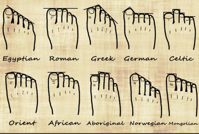 scoopalley's tweet photo. Ok. This could be your last chance. If your toes match the Roman, Greek, German or Celtic pattern, you could qualify for EU citizenship. #RejoinEU https://t.co/QFX5uifk7E