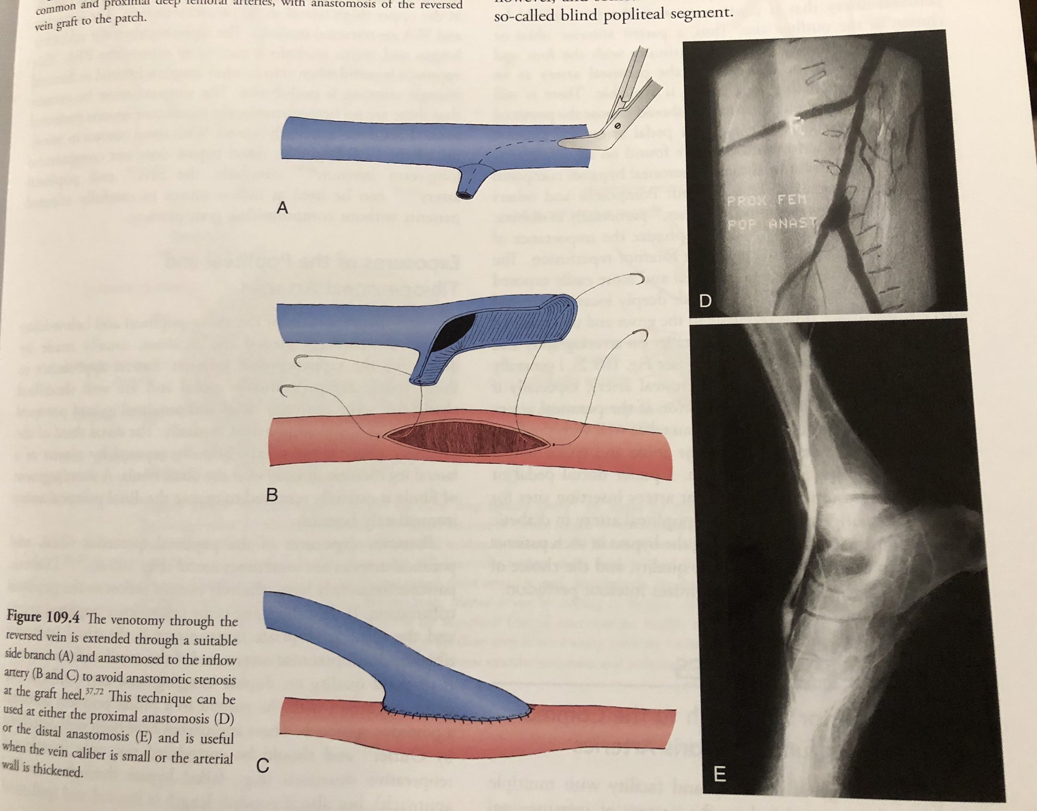 E-books – Proximal