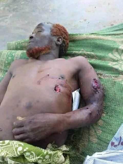 Magartu12's tweet photo. @PMEthiopia Justices for Oromo peoples. 😭💔😡👇🏼 https://t.co/NUDlianL6C