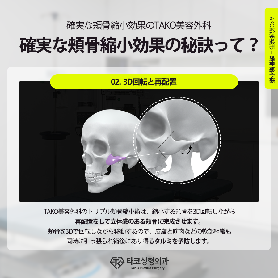 Tako美容外科 失敗しない頬骨縮小術の秘訣って 気になる方はtakoの公式ブログで 確認してみてください T Co Nmzuj6rhn9 Tako美容外科 キムタクホ 輪郭整形 輪郭 頬骨縮小 整形情報 Tako美容外科 失敗しない頬骨縮小術の秘訣って 気になる方はtakoの公式ブログで 確認してみてください T Co Nmzuj6rhn9 Tako美容外科 キムタクホ 輪郭整形 輪郭 頬骨縮小 整形情報
