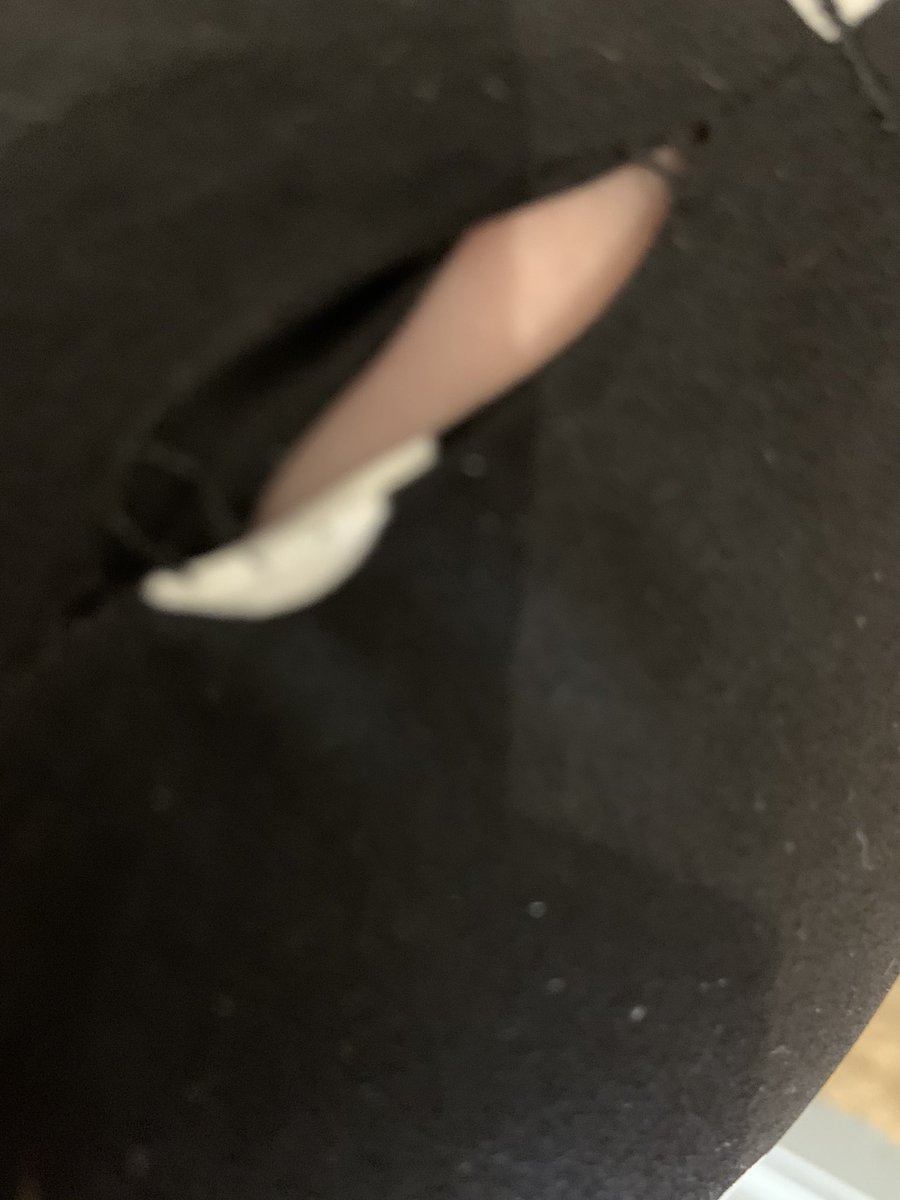 VictoriaRose1's tweet photo. @hmunitedkingdom just received this dress I bought for my holiday next week with a huge rip in it! Can someone contact me ASAP to either refund me or send a replacement urgently so I get it in time. Thank you https://t.co/gulVe3Lf0v