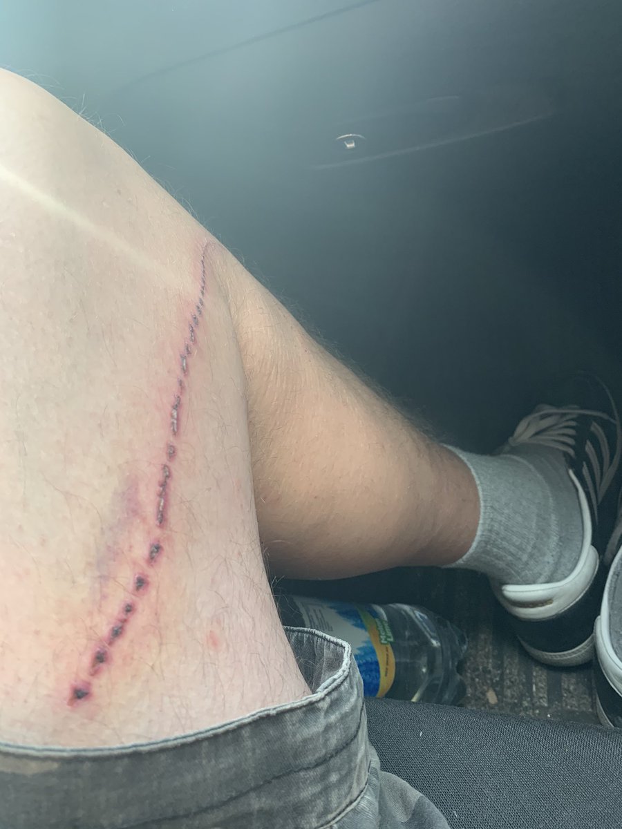 Papanomaly tweet media