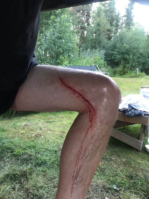 Papanomaly tweet media