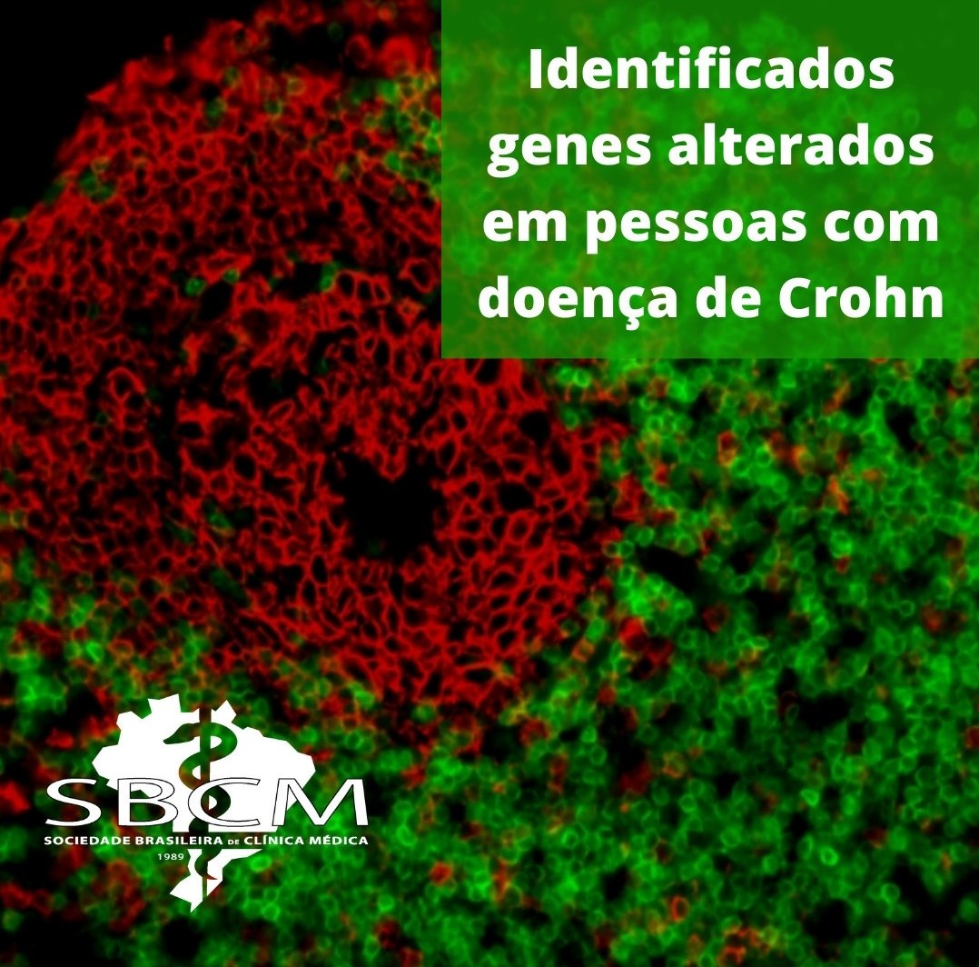 SbcmNacional's tweet image. Pesquisadores de Campinas e de Barcelona identificaram #genes cuja atividade está alterada no #intestino de pacientes com a #doencadeCrohn. A descoberta pode levar a formas mais eficientes de predição e #tratamento.  
 
Saiba mais: bit.ly/3aJPgzC.