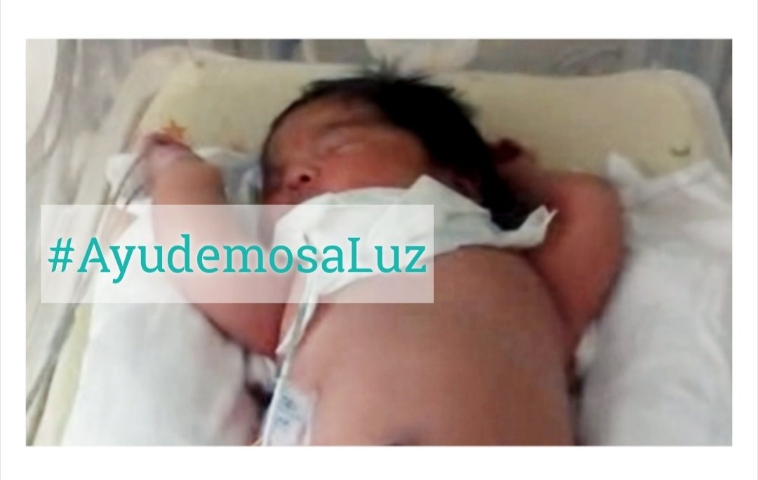 CorpusInfinite's tweet photo. Se llama Luz María, nació hace dos semanas en Piura(Perú) y tuvo que ser intervenida de urgencia del corazón. Por favor necesitamos una recaudación urgente para ayudar a su familia a costear los gastos médicos.
Por MD os mandaré enseguida toda la información para donar♥️
Gracias https://t.co/f9BDRYWDdY