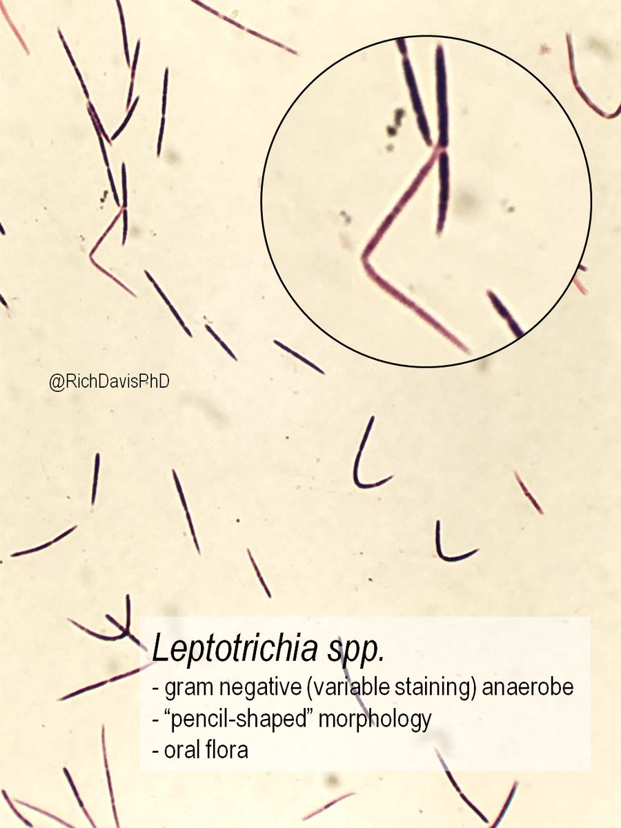 richdavisphd's tweet photo. #MicroRounds (Day 715): From the archives, an anaerobe with a distinct Gram stain. Gram negative (but often variable) Leptotrichia spp are oral flora that divide into long "pencil-like" morphology (think two pencils touching eraser ends). #ASMClinMicro #IDTwitter https://t.co/SgHzVFckGd