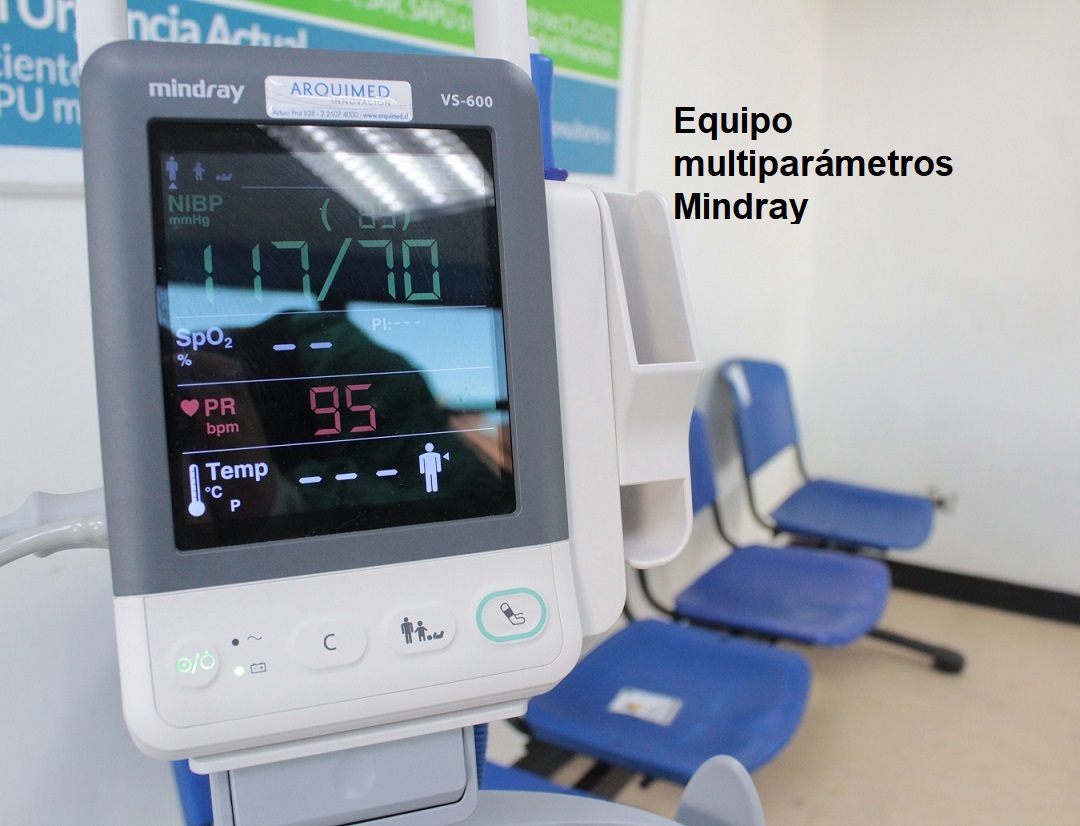 Unidad de Urgencias recibe ventilador mecánico de transporte de última generación y otros equipos de apoyo

LINK ARTICULO : hospitalancud.gov.cl/index.php/noti…