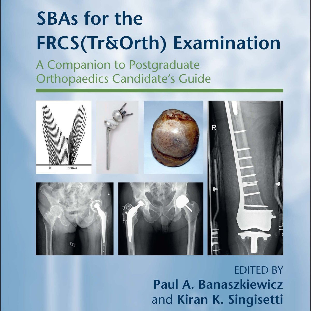 PG_Orthopaedics (@pg_orthopaedics) on Twitter photo Our new SBA book due out December.Over 1,000 new level 2 higher-order thinking single best answer questions.The book is on its home straight now for release .Even better been updated to a colour book production <a href="/bota_uk/">BOTA</a>  <a href="/SYorksOrthoRegs/">South Yorkshire Orthopaedics</a> <a href="/LiverpoolTrauma/">Liverpool Orthopaedic and Trauma Student Society</a> <a href="/EUOrthoSoc/">Edinburgh University Trauma & Orthopaedics Society</a> <a href="/Orthnorth1/">Orthnorth Teaching & Education Association</a> Our new SBA book due out December.Over 1,000 new level 2 higher-order thinking single best answer questions.The book is on its home straight now for release .Even better been updated to a colour book production <a href="/bota_uk/">BOTA</a>  <a href="/SYorksOrthoRegs/">South Yorkshire Orthopaedics</a> <a href="/LiverpoolTrauma/">Liverpool Orthopaedic and Trauma Student Society</a> <a href="/EUOrthoSoc/">Edinburgh University Trauma & Orthopaedics Society</a> <a href="/Orthnorth1/">Orthnorth Teaching & Education Association</a>