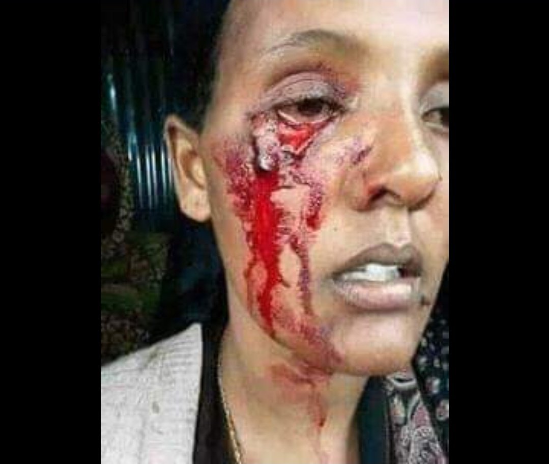 Samira81538271's tweet photo. #justiceforHacaluuHundessa
#stopkillingoRomoopeopleplease
#StopFundingHate
#JusticeForOromoo https://t.co/WftgANvDEr