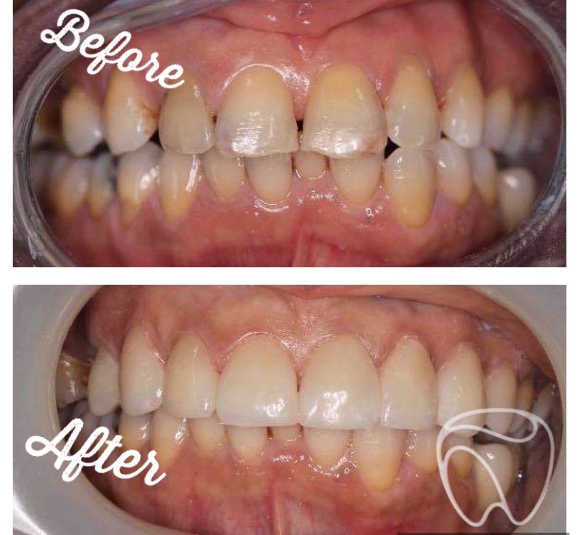 LabExcellence's tweet photo. #dentistry https://t.co/N8NBNSInfp
