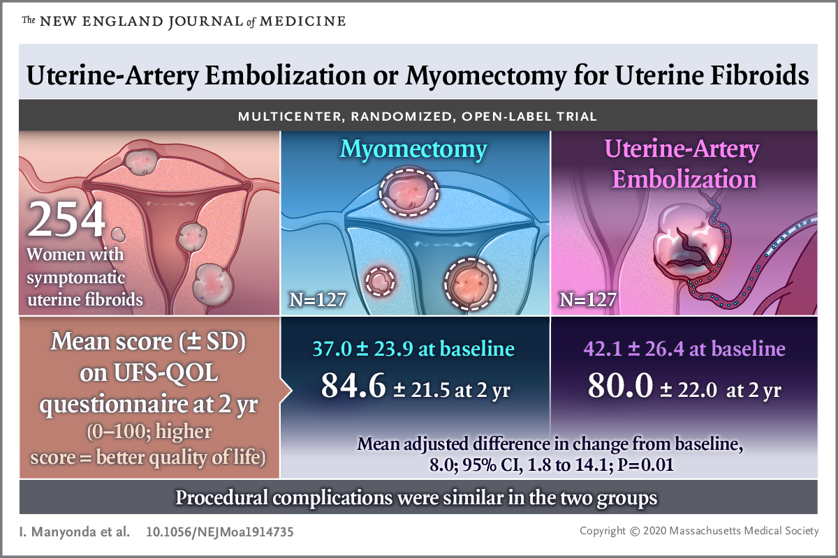Among women with symptomatic uterine fibroids, both uterine-fibroid embolization (UFE) and myomectomy significantly improve fibroid-related quality-of-life (QOL)

(w/ myomectomy providing "small-to-moderately" better QOL than #UFE at 2 years)

pubmed.ncbi.nlm.nih.gov/32726530/
