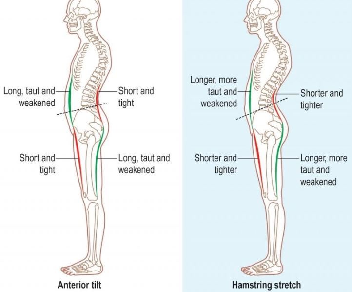 If we're going to train the hamstrings, a neutral ribcage over pelvis (stack) is especially going to be important here. Being excessively extended (arched forward in the low back) is going to eccentrically orient the hamstrings and then we will have to overcome the