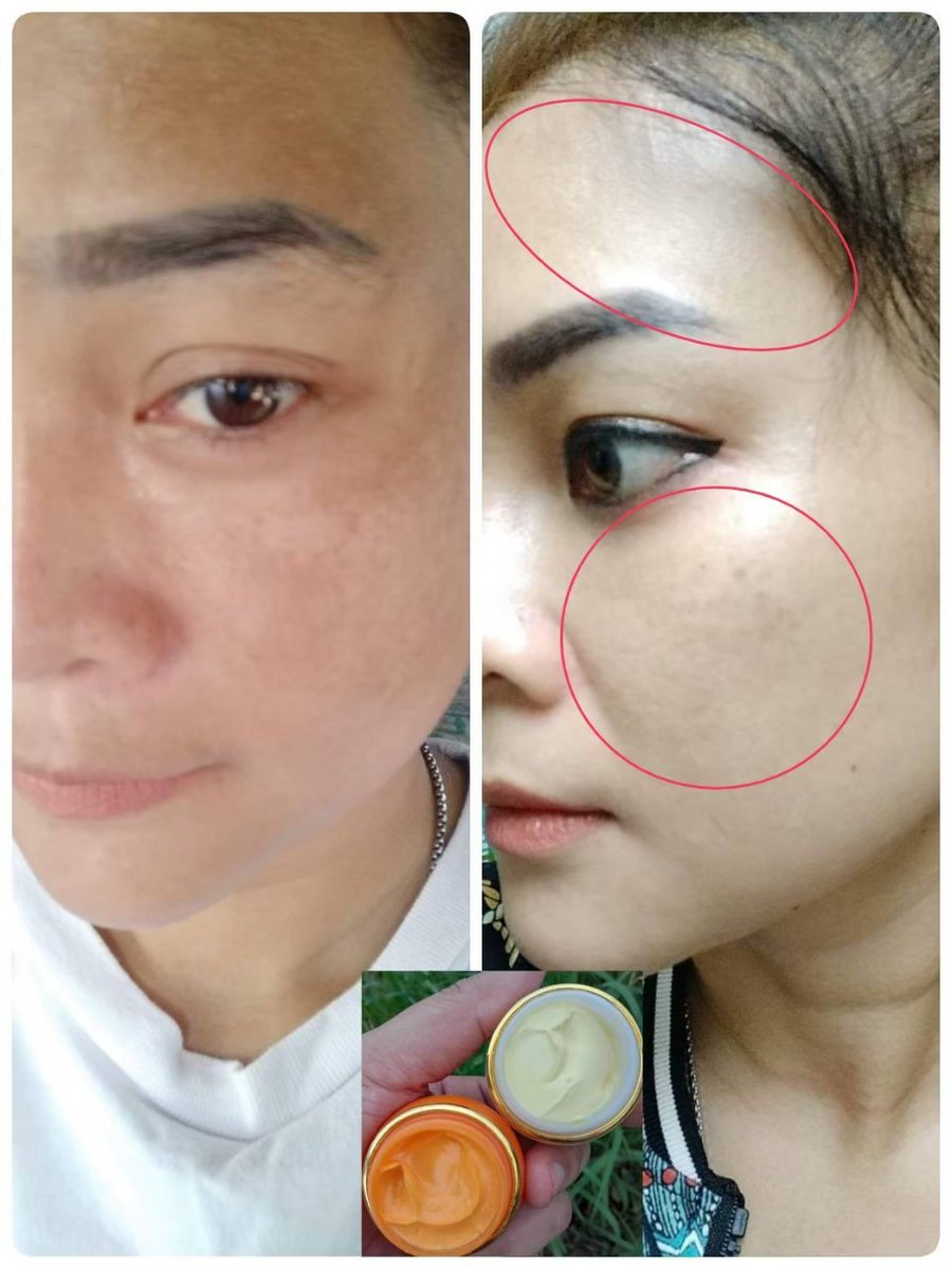 creamkhaimouk's tweet photo. 💢ເອົາຣີວິວມາຝາກ ໃຊ້ດີບອກຕໍ່ຈ່ະ 
💸ຊຸດ90.000ກີບ
#ໄຂ່ມຸກປະສົມບົວຫິມະ💯 🎗️ https://t.co/wB6v4NCqPH