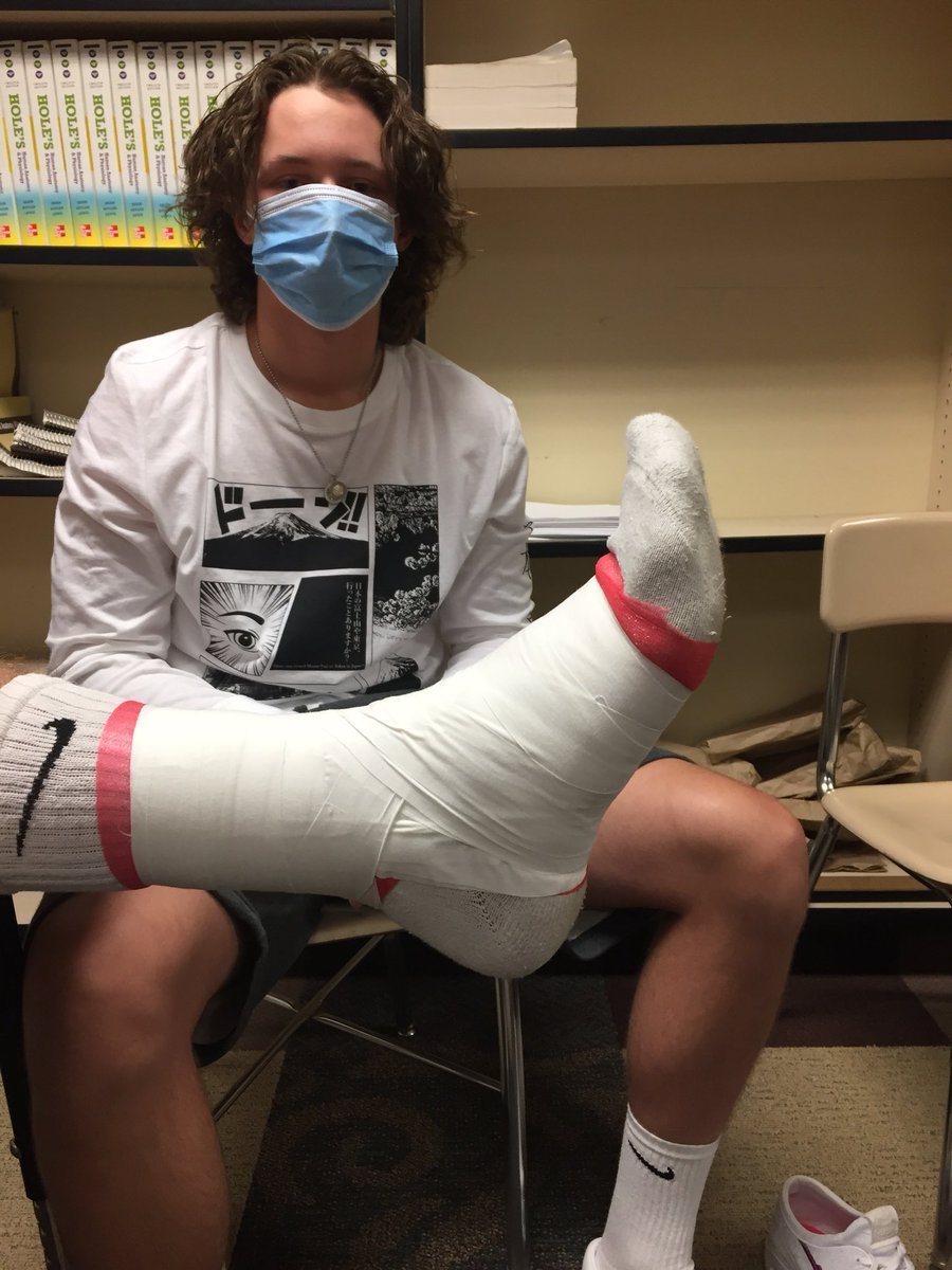 arobinsonSSRAMS's tweet photo. 1st day taping in Sports Med!!! I like to take before pics and compare them to the improve at the end #seviersdstrong #sshsrams #sssportsmed https://t.co/tpx4B0QyyA
