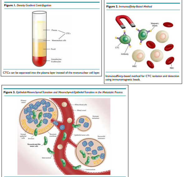 PLMOJ1's tweet photo. Circulating Tumor Cells: Beyond Isolation and Detection
Article Link: https://t.co/bcefEocjeq
#CirculatingTumorCell #Circulating #TumorCell #Cancer #Isolation #Detection #Metastasis #Pathology #LaboratoryMedicine https://t.co/YFeyAmdC54