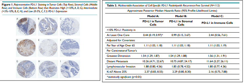 PLMOJ1's tweet photo. The Prognostic Value of PD-L1 Expression in Triple-Negative
Breast Cancer: A Cohort Study and Systematic Literature Review
Article Link: https://t.co/0TBF0uh179
#Breast #TripleNegative #ImmunoOncology #TNBC #TMA #Prognosis #Pathology #LaboratoryMedicine https://t.co/ODQ91tueRS