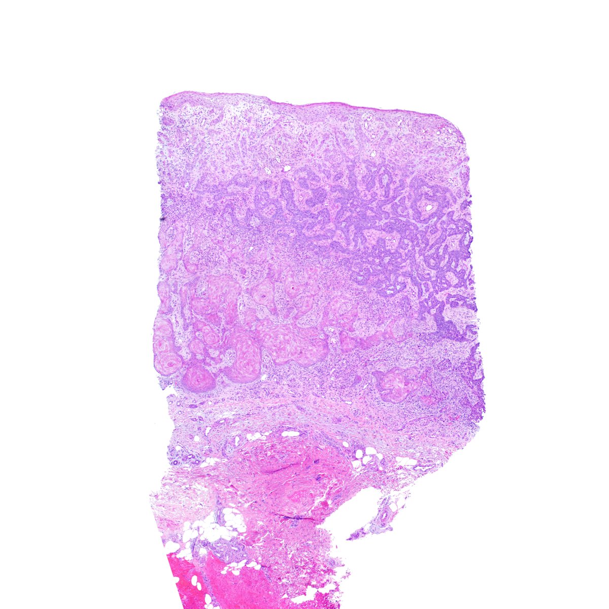 What do you want to call it? #dermpath