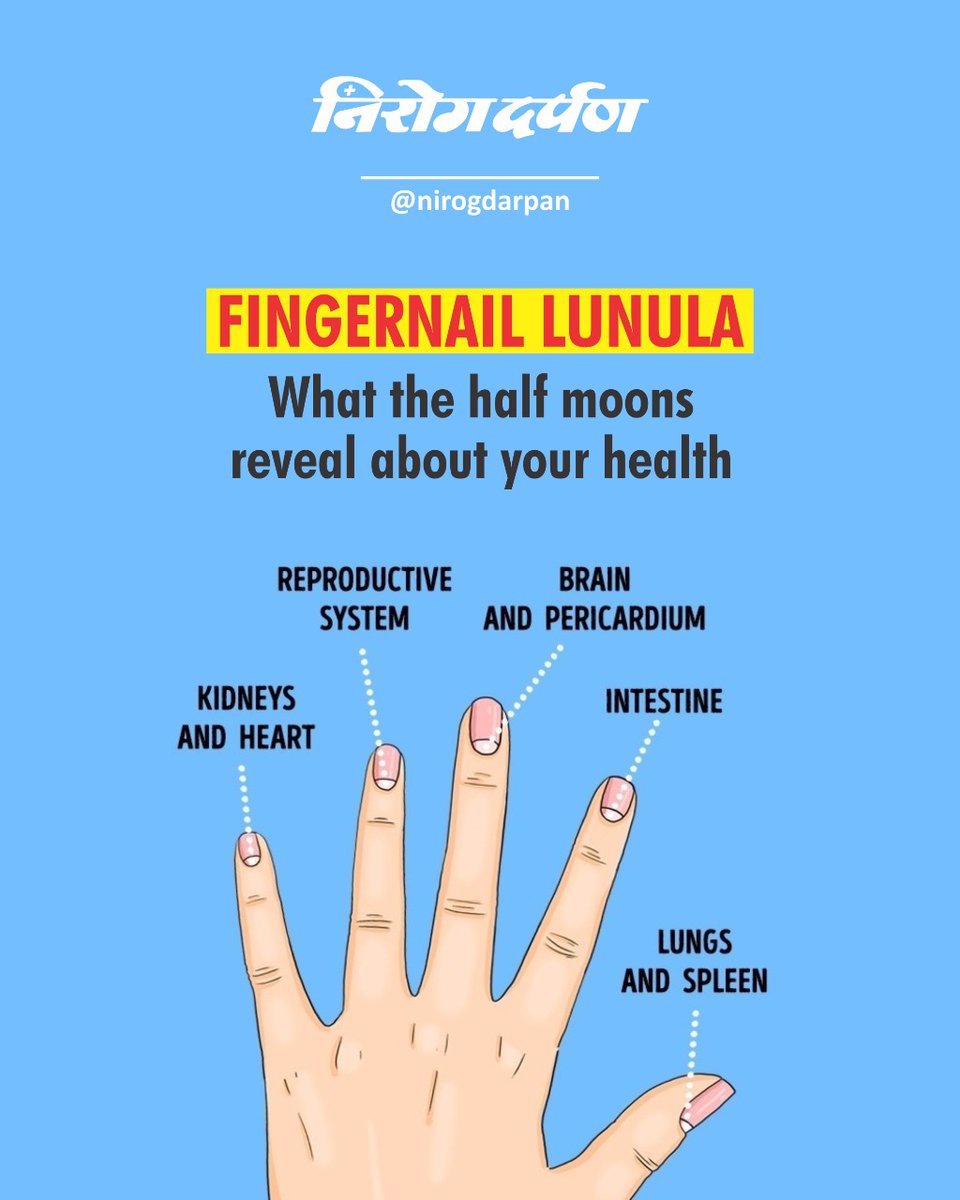Large Lunulae or Half-moon at Fingernail with Vertical Lines of Asian,  Chinese Old Man Stock Image - Image of defect, problem: 240745823