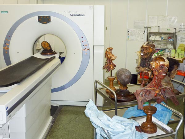 [4/5] Allegedly some of these anatomists were still resenting the academic world for not letting them in, when they died.But today there's no real "mystery" anymore: historians and paleoanthropologists have been able to unearth most of their methods.