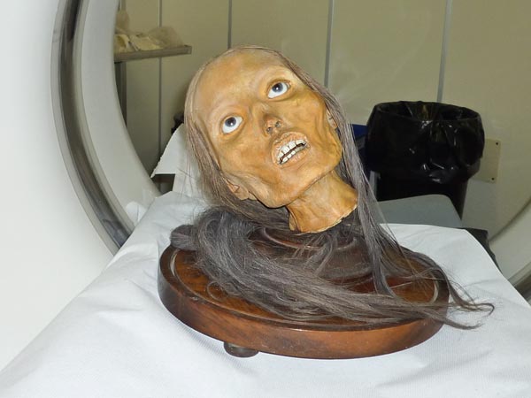 [4/5] Allegedly some of these anatomists were still resenting the academic world for not letting them in, when they died.But today there's no real "mystery" anymore: historians and paleoanthropologists have been able to unearth most of their methods.