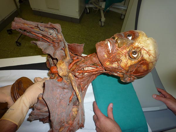 [4/5] Allegedly some of these anatomists were still resenting the academic world for not letting them in, when they died.But today there's no real "mystery" anymore: historians and paleoanthropologists have been able to unearth most of their methods.