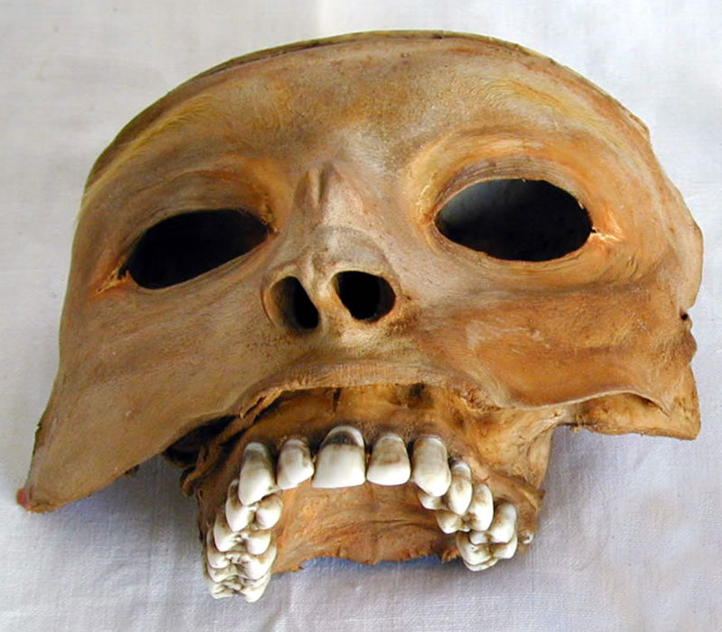 [2/5] Most petrifiers were self-taught anatomists. They developed their methods by working on animal specimens, and later experimented on unclaimed cadavers.