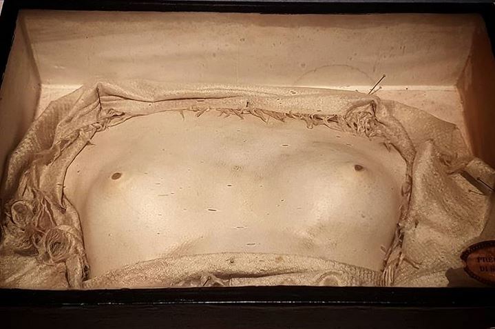 [2/5] Most petrifiers were self-taught anatomists. They developed their methods by working on animal specimens, and later experimented on unclaimed cadavers.