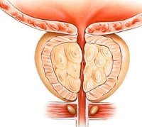 حدوث تضخم بالبروستاتا يتسبب في احتباس البول بالجسم.