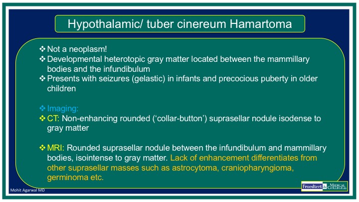 PublishedXPrime's tweet photo. #MCWNeuroradBTW 002 Answers: Hypothalamic/tuber cinereum hamartoma.

Check out the cool labeled 3rd Vent anatomy!

Big thanks to those who participated 

@RGovindiah  @Jaswal_Shama @dr_srikantnalla @drvenki_143  

#FOAMed #FOAMrad #radres #MedEd #RadEd #neurotwitter #NeuroRad https://t.co/ipL4621B5m