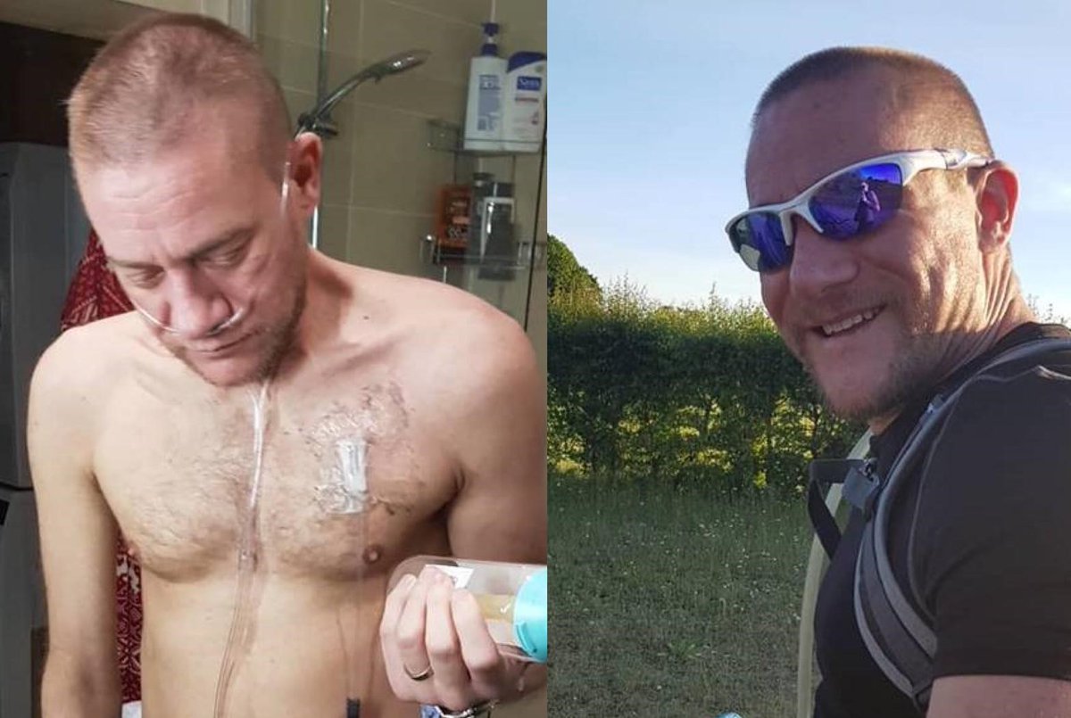 ‘I’m stronger than I have ever been.’ 

Darren has #CysticFibrosis, and a few months ago his clinicians started talking to him about end of life care. Within days of taking Kaftrio, Darren was able to start exercising, and now goes on 10-mile bike rides with his wife. 🚴‍♂️