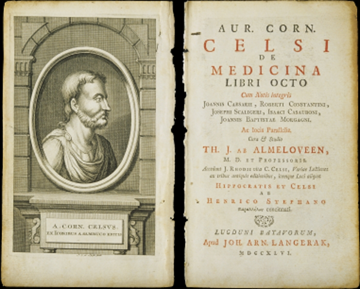 The tetrad of physical findings Calor, dolor, rubor, and tumor originally recorded by the Roman encyclopedist A. Cornelius Celsus-1st century A.D. that are taught in med school are in actuality non-specific markers ofinflammationCelsus AC., De medicina. Self published; A.D. 25.