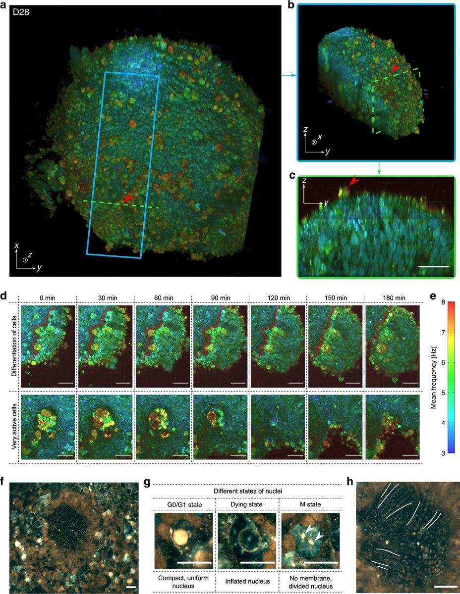 InstVisionParis's tweet photo. Dynamic #FFOCT: 3D live-imaging of #retinal #organoids
a new way to identify specific cells in living tissue via their function. Congratulations ! J.Scholler, K.Groux, O. Goureau, J.-A.Sahel, M.Fink, S. Reichman, C. Boccara & K.Grieve
Pub: https://t.co/0VpDoQI0SW https://t.co/jM3QnSAU8D