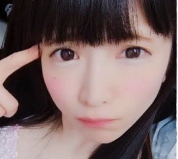 もえあずの顔がパンパンに腫れていて違和感 病気 整形 と心配の声 まとめダネ もえあずの顔がパンパンに腫れていて違和感 病気 整形 と心配の声 まとめダネ