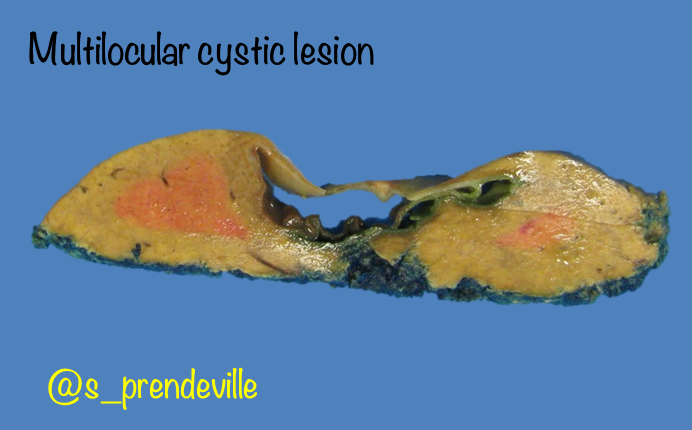 Susan Prendeville tweet media