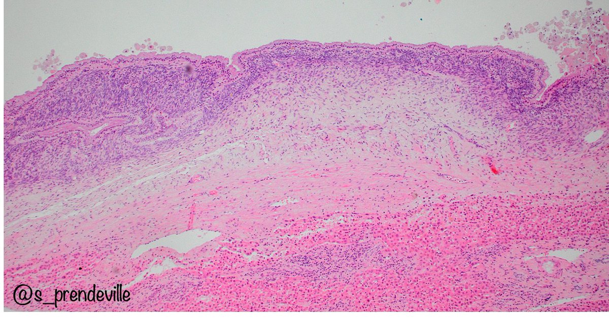 Susan Prendeville tweet media