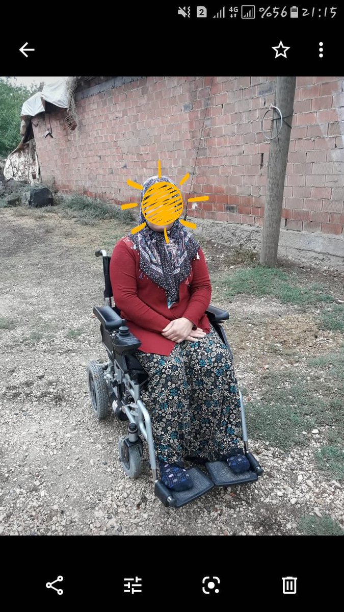 Sckntkn's tweet photo. @ahbapdiyarbakir @ahbapplatformu
@haluklevent @Haydi_Ahbap
Elif abla damdan düşmüş ve spinal kordu ( omuriliği) yaralanmış bir hastamız.  Ayakta durması ve destekle yürümesi için bir kaç cihaz almamız gerekiyor . Bunun için yardıma ihtiyacımız var ... https://t.co/n1sQiH99c9