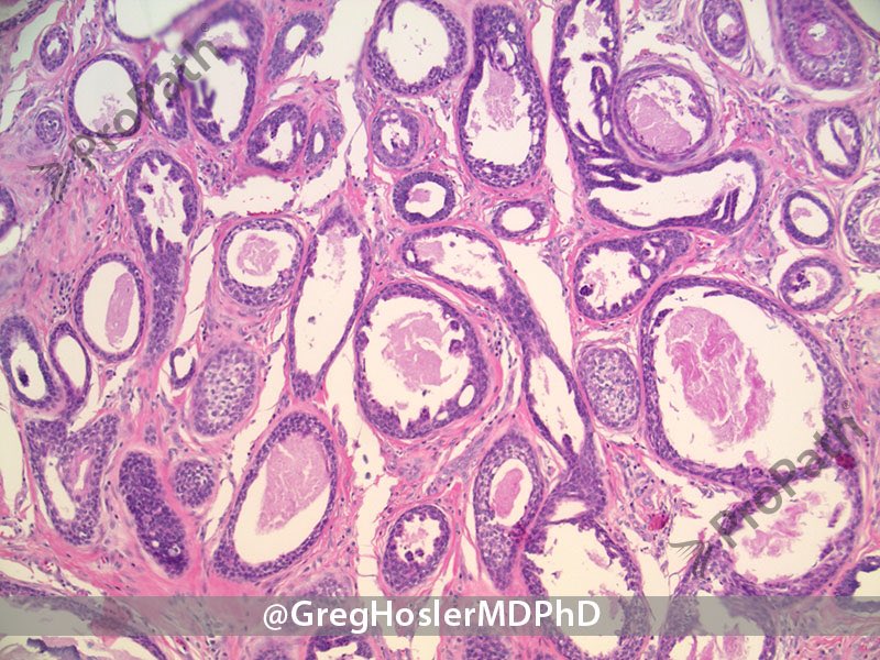 Gregory A Hosler tweet media