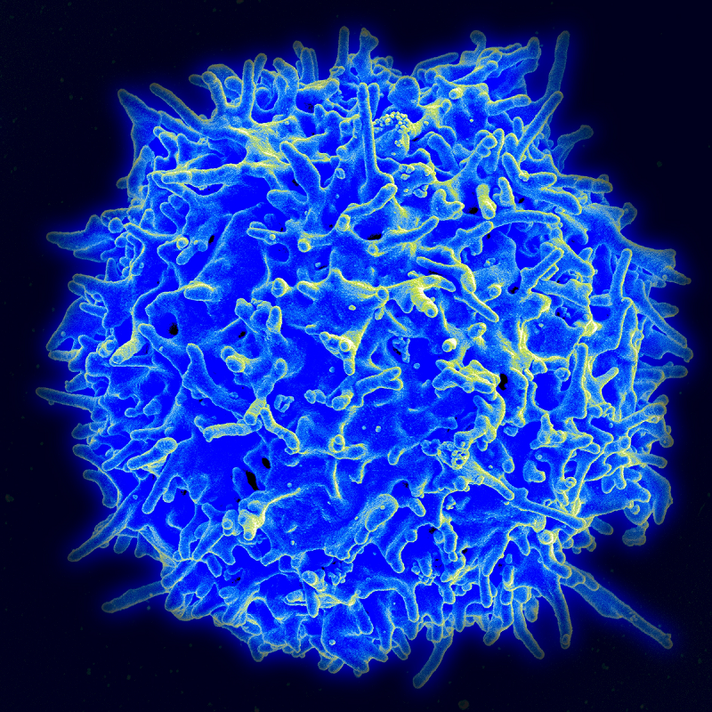 BCMFromtheLabs's tweet photo. Posted on @ScienceDaily, work from Dr. M Mamonkin @MaxMamonkin, @feiyan_mo et al showing an improved way to treat #cancer #OffTheShelf #CARTcells #ImmuneRejection @NatureBiotech
#NKcells @CAGTHouston @TexasChildrens https://t.co/rWYAI2tJ6S https://t.co/DselokLwCp