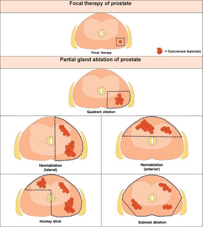 European Urology tweet media