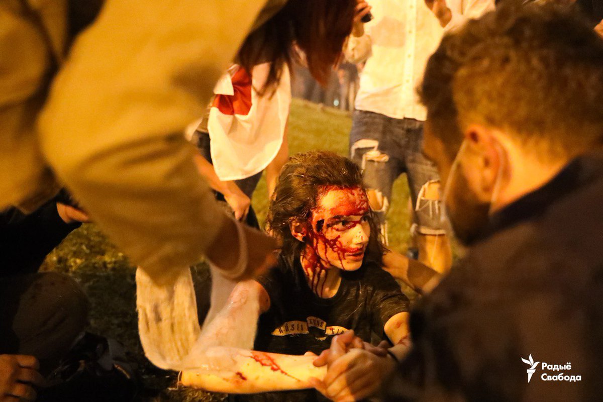 Protesters wounded during clashes with security forces in Minsk tonight.