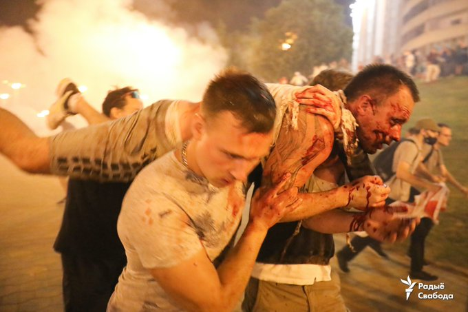 YourAnonCentral's tweet photo. TW Images of injured protestors brutally attacked by Lukashenko regime police forces. Light explosives thrown at people, severe injuries reported. #Belarus https://t.co/5xKSVfzgx2