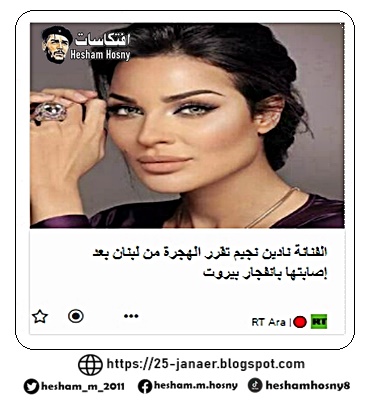 الفنانة نادين نجيم تقرر الهجرة من لبنان بعد إصابتها بانفجار بيروت