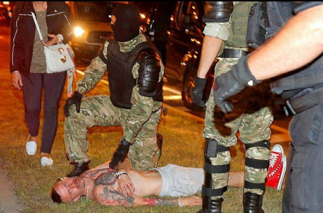  #Belarus: this protester was seriously injured by riot police in  #Minsk. Some reports say he passed anyway but nothing is certain as of yet