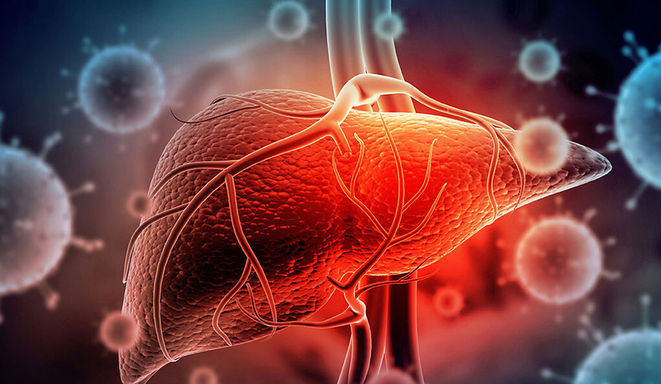 Researchnewscc's tweet image. Strong link found between abnormal liver tests and poor COVID-19 outcomes ow.ly/IAt650AUJRc #stronglink #livertests #COVID19outcomes #science #newspaper
