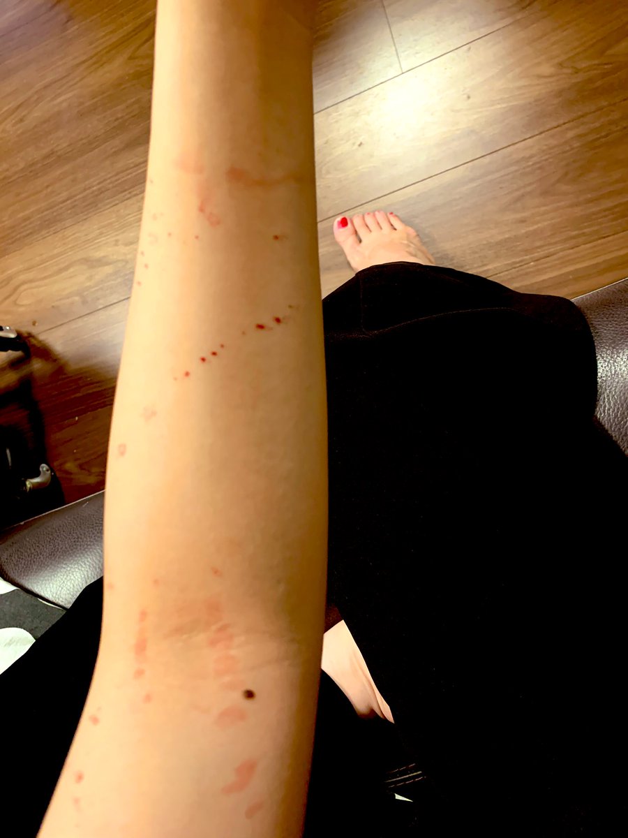 おるか こわ お気をつけて