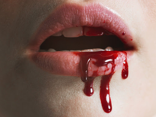 SA_Vcommunity's tweet photo. Enfermedades relacionadas al "Vampirismo"

En este post les traemos algunas de las enfermedades conocidas por el hombre, que se relacionan generalmente al "Vampirismo", destacamos que ninguna de ellas describen nuestra Condición.

https://t.co/Yx5sFn10NH https://t.co/JprroM1MB9