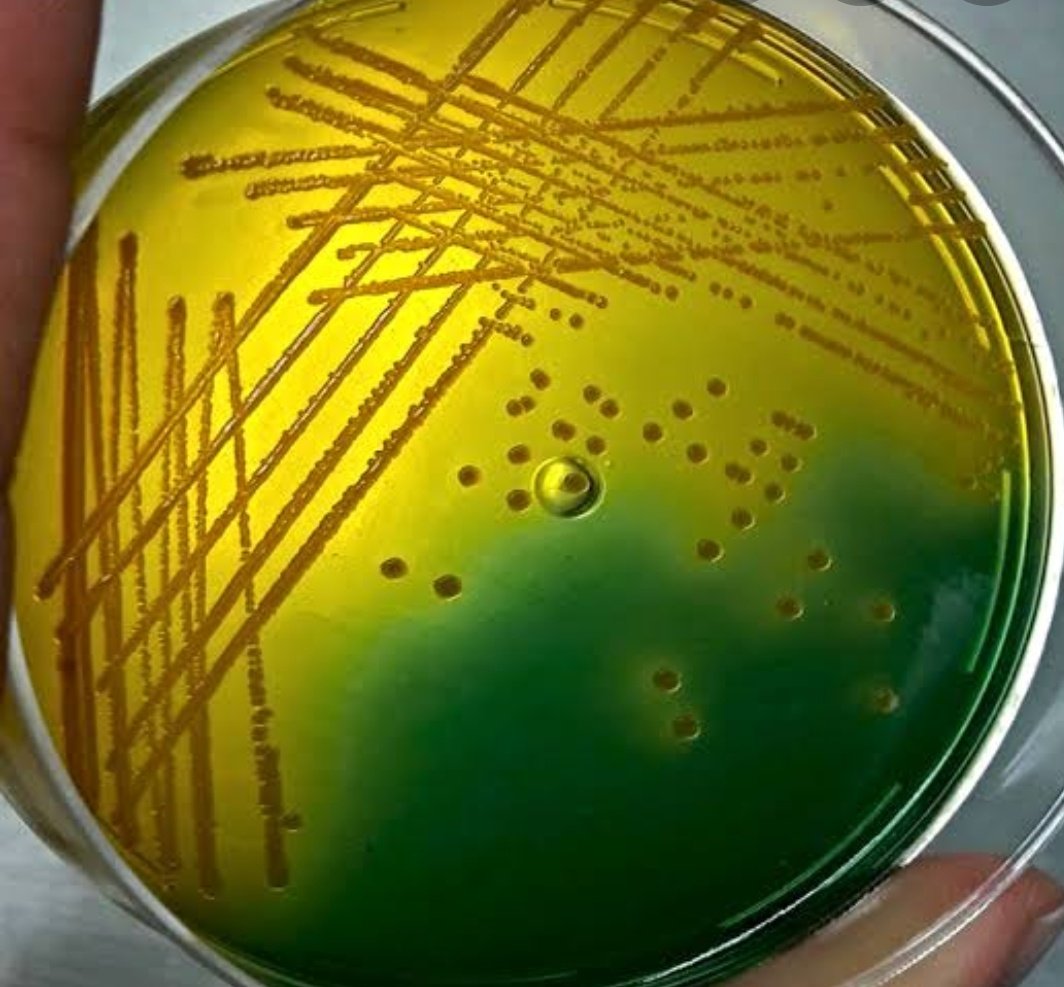 Микроорганизмы на плотных питательных средах